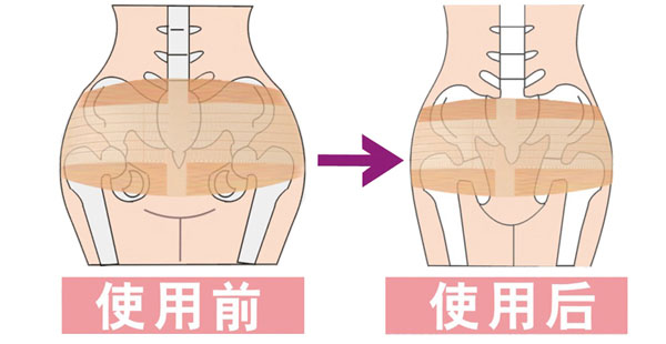 【十月情】fd05膚色 產後盆骨帶 矯正帶收胯帶